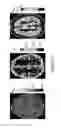 Fig. 06 - High-resolution metabolic neuroimaging