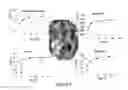 Fig. 07 - High-resolution metabolic neuroimaging