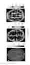 Fig. 10 - High-resolution metabolic neuroimaging