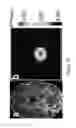 Fig. 11 - High-resolution metabolic neuroimaging