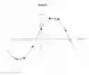 Fig. 09 - REAL-TIME IN VIVO MEASUREMENT OF THE 3D ANGULAR ORIENTATION OF CARDIOVASCULAR STRUCTURES