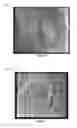 Fig. 12 - REAL-TIME IN VIVO MEASUREMENT OF THE 3D ANGULAR ORIENTATION OF CARDIOVASCULAR STRUCTURES