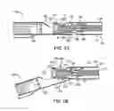 Fig. 03 - Atherectomy catheters with imaging