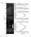 Fig. 06 - Apparatus for ultrasound flow vector imaging and methods thereof