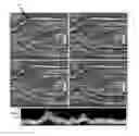 Fig. 07 - Apparatus for ultrasound flow vector imaging and methods thereof
