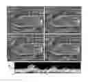 Fig. 08 - Apparatus for ultrasound flow vector imaging and methods thereof