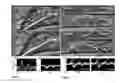 Fig. 10 - Apparatus for ultrasound flow vector imaging and methods thereof