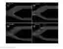 Fig. 13 - Apparatus for ultrasound flow vector imaging and methods thereof