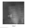 Fig. 28 - System and method useful for sarcomere imaging via objective-based microscopy