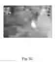 Fig. 26 - Tissue illumination system, device, and method