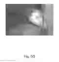 Fig. 27 - Tissue illumination system, device, and method