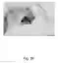 Fig. 29 - Tissue illumination system, device, and method