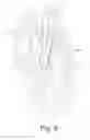 Fig. 32 - Tissue illumination system, device, and method