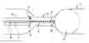 Fig. 01 - BALLOON CATHETER FOR MEASURING THE LENGTH OF A STENOSIS