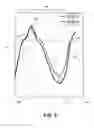 Fig. 08 - Method and system to measure cardiac motion using a cardiovascular navigation system