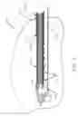 Fig. 10 - Biopsy device with translating valve member