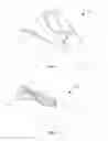Fig. 03 - NEEDLE BIOPSY SYSTEMS AND METHODS