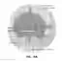 Fig. 13 - Method for providing directional therapy to skeletal joints