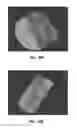 Fig. 47 - Method for providing directional therapy to skeletal joints