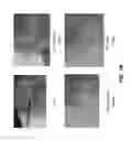 Fig. 49 - Method for providing directional therapy to skeletal joints