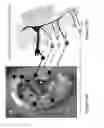 Fig. 14 - Device, system and method for reducing headache pain
