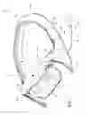 Fig. 02 - Systems and methods for decompression and elliptical traction of the cervical and thoracic spine