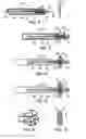 Fig. 04 - Device and method for establishing an artificial arterio-venous fistula
