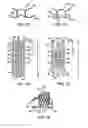Fig. 05 - Device and method for establishing an artificial arterio-venous fistula