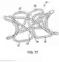Fig. 06 - Device and method for establishing an artificial arterio-venous fistula