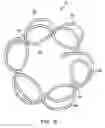 Fig. 07 - Device and method for establishing an artificial arterio-venous fistula