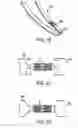Fig. 08 - Device and method for establishing an artificial arterio-venous fistula