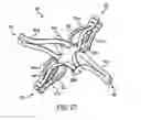 Fig. 10 - Device and method for establishing an artificial arterio-venous fistula