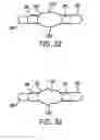 Fig. 13 - Device and method for establishing an artificial arterio-venous fistula