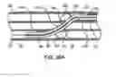 Fig. 15 - Device and method for establishing an artificial arterio-venous fistula