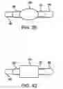 Fig. 20 - Device and method for establishing an artificial arterio-venous fistula
