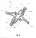 Fig. 22 - Device and method for establishing an artificial arterio-venous fistula