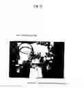 Fig. 06 - Abnormal electrical conduction blocking apparatus using photodynamic therapy (PDT)