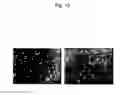 Fig. 18 - Abnormal electrical conduction blocking apparatus using photodynamic therapy (PDT)
