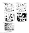 Fig. 28 - Abnormal electrical conduction blocking apparatus using photodynamic therapy (PDT)