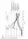 Fig. 29 - Abnormal electrical conduction blocking apparatus using photodynamic therapy (PDT)