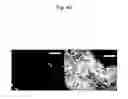 Fig. 48 - Abnormal electrical conduction blocking apparatus using photodynamic therapy (PDT)