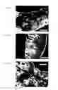 Fig. 49 - Abnormal electrical conduction blocking apparatus using photodynamic therapy (PDT)