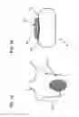 Fig. 02 - METHODS AND DEVICES TO DECREASE TISSUE TRAUMA DURING SURGERY