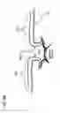 Fig. 10 - METHODS AND DEVICES TO DECREASE TISSUE TRAUMA DURING SURGERY