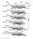 Fig. 102 - METHODS AND DEVICES TO DECREASE TISSUE TRAUMA DURING SURGERY