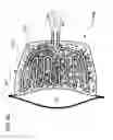 Fig. 14 - METHODS AND DEVICES TO DECREASE TISSUE TRAUMA DURING SURGERY