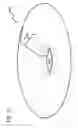 Fig. 17 - METHODS AND DEVICES TO DECREASE TISSUE TRAUMA DURING SURGERY