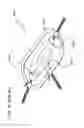 Fig. 23 - METHODS AND DEVICES TO DECREASE TISSUE TRAUMA DURING SURGERY