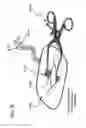 Fig. 25 - METHODS AND DEVICES TO DECREASE TISSUE TRAUMA DURING SURGERY