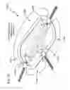 Fig. 26 - METHODS AND DEVICES TO DECREASE TISSUE TRAUMA DURING SURGERY
